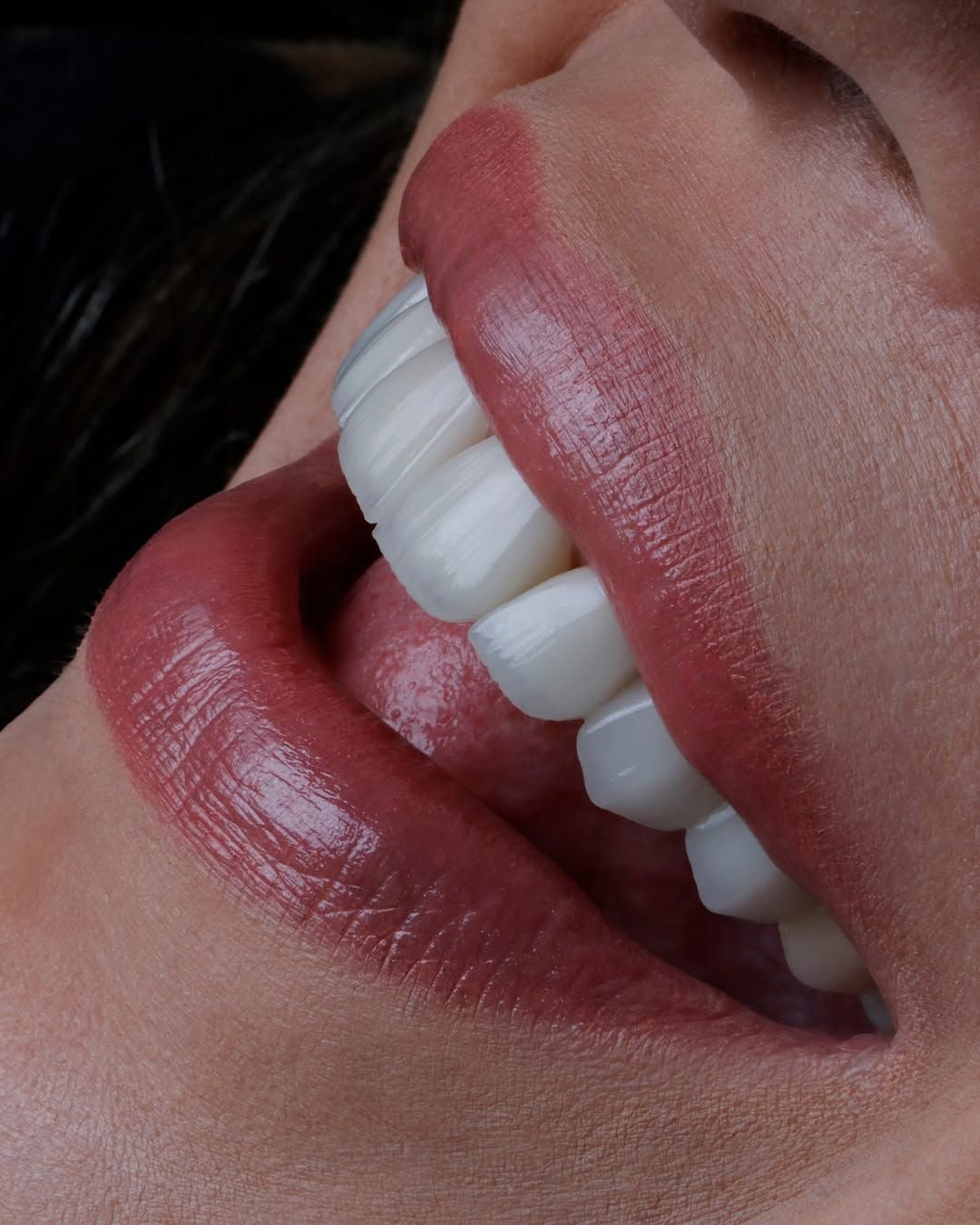 Formation blanchiment dentaire